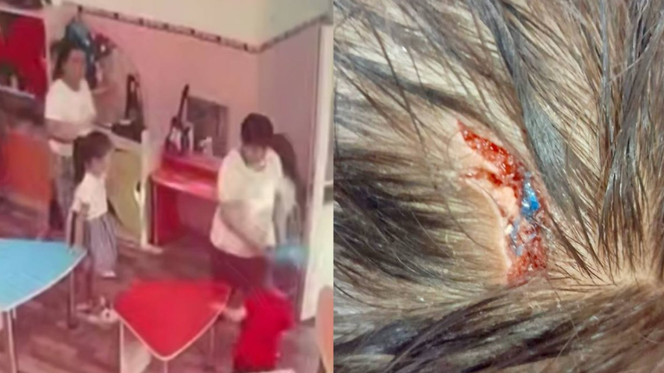 Таразда балабақша тәрбиешісі бүлдіршіннің басын жарып тастаған (ВИДЕО)