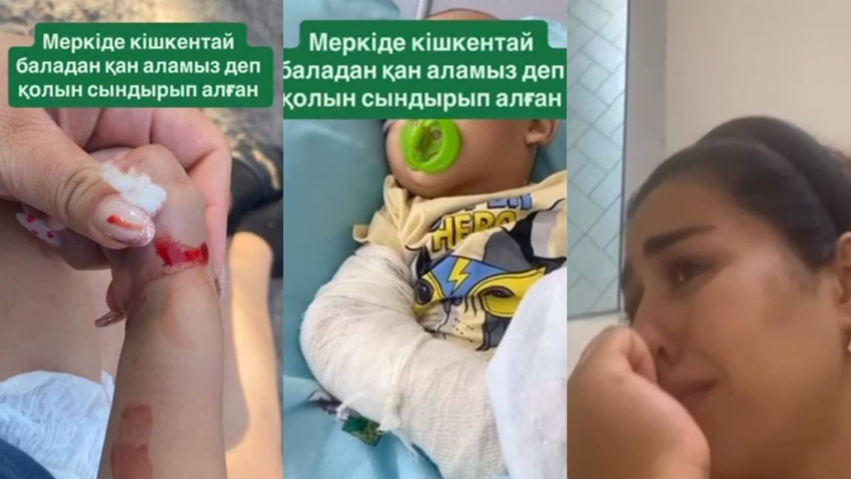 «Дені сау баланы ауру қылды»: ата-ана медбикелерді баласының қолын сындырды деп айыптауда