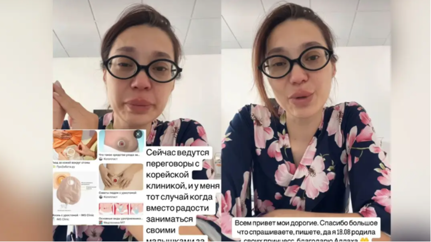 Ақтөбелік дәрігерлер босанған ананың жатыры мен қуығын бірге тігіп жіберген