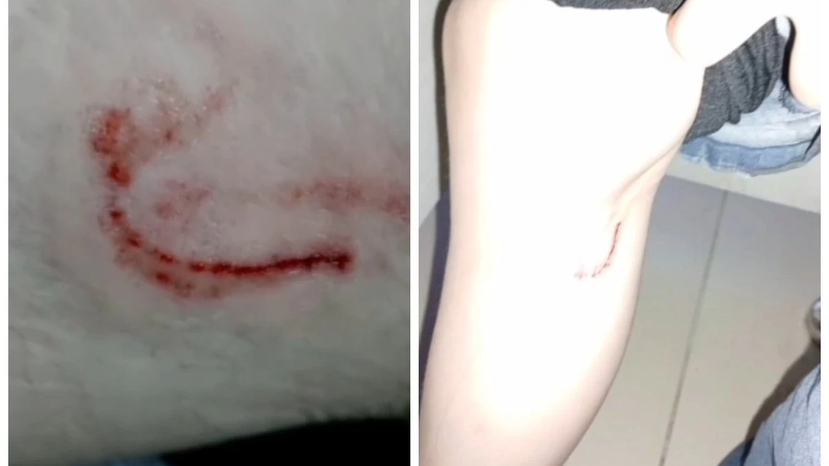 Көкшетауда 15 жастағы қызды көше иттері талап тастады (ВИДЕО)