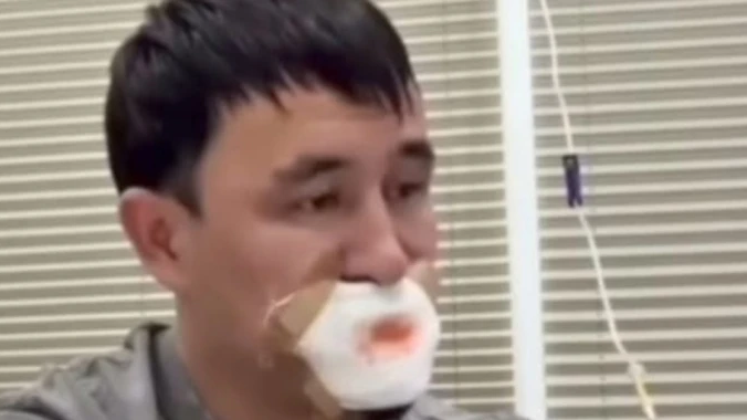 Қызымен сүйісіп тілінен айырылған жігіт туралы тың деректер тарады