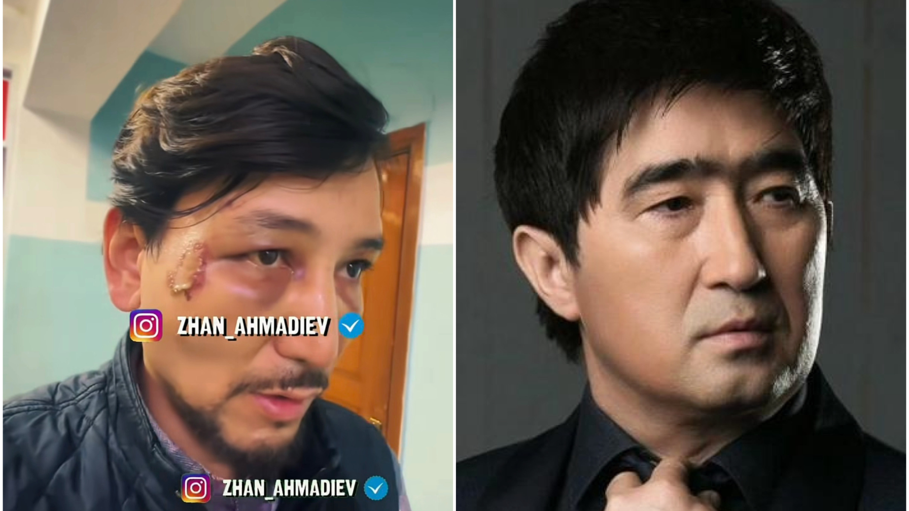  «Кешірмеймін»:  Ғалымжан Сүлеймен өзін соққыға жыққан адамдарды жауапқа тартуды талап етті (ВИДЕО)