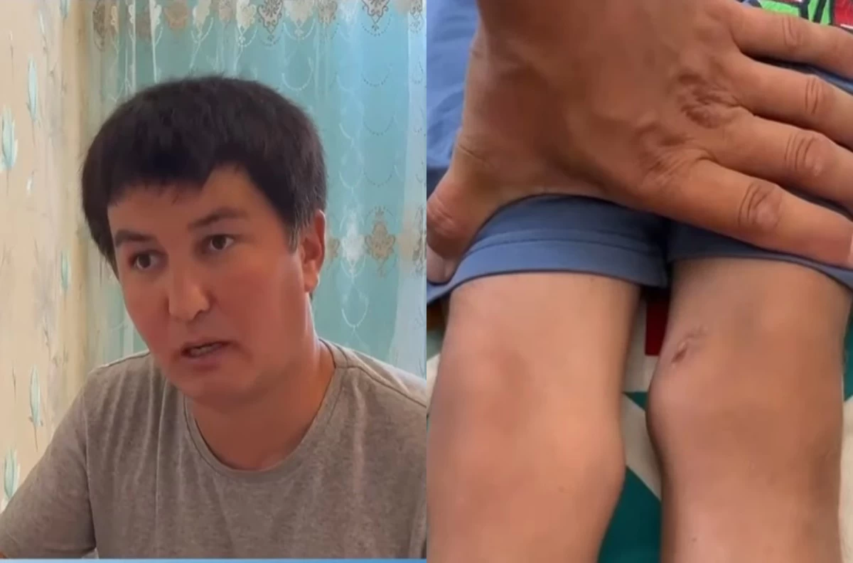 Жаңаөзенде лицензиясыз орталықтың біліксіз массажисі баланың аяғын сындырып алған
