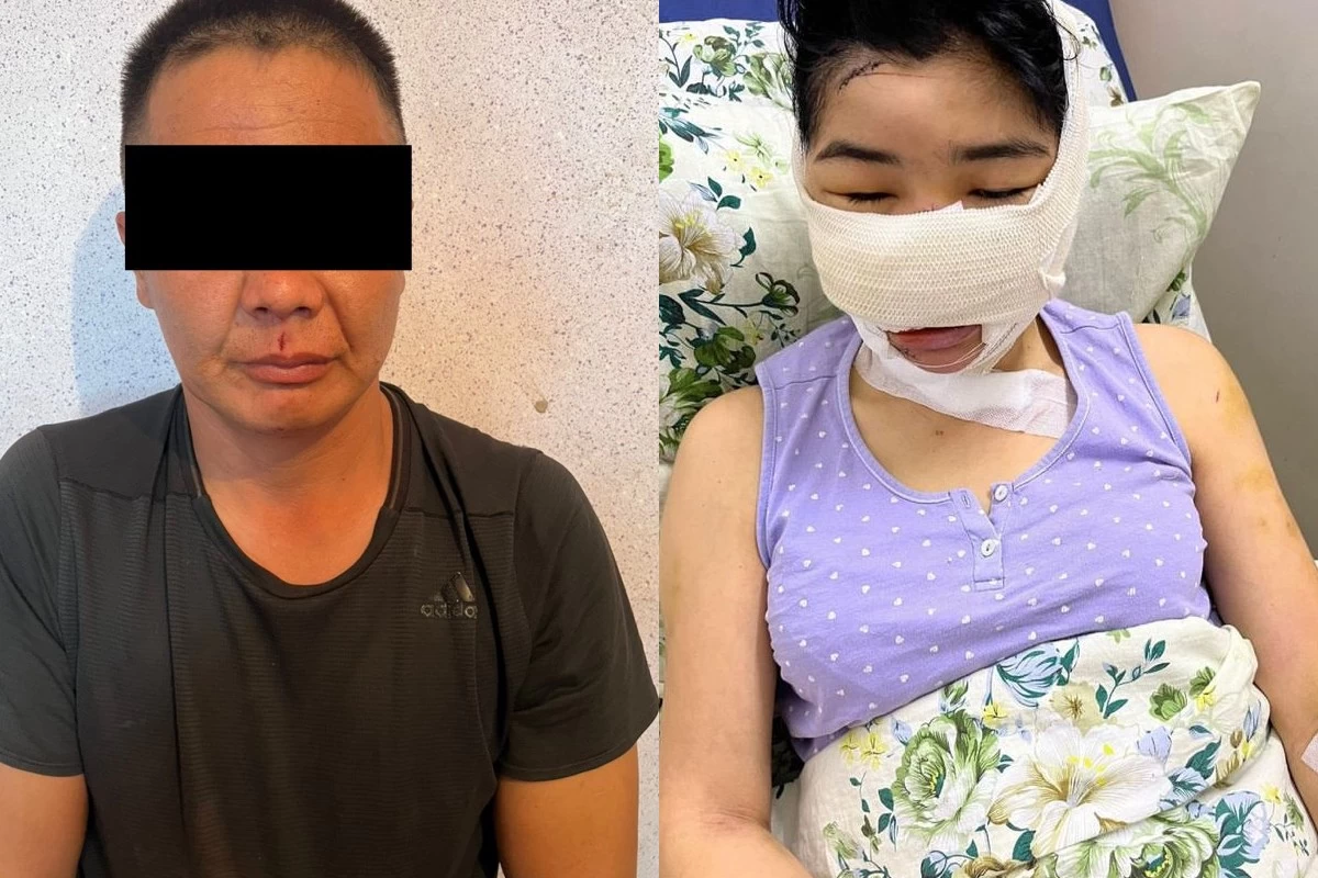 "Мұрны мен құлағын кескен": Ер адам бұрынғы әйелін аяусыз қорлағаны туралы оқиға куәгерлері айтып берді