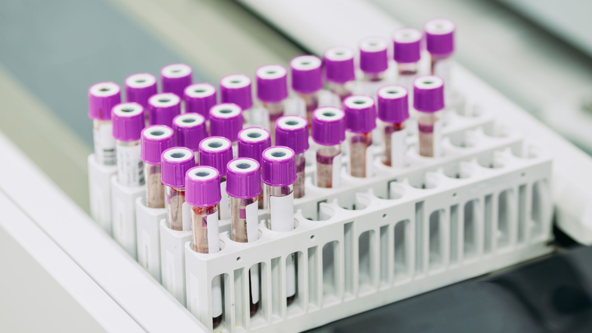 Қарағанды ​​облысында ер адам бірнеше әйелге үйленіп, ЖИТС инфекциясын әдейі жұқтырған