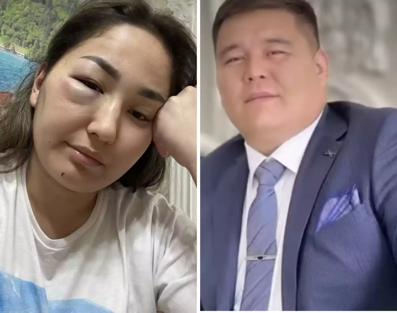 «Тағы +1 әйел сабағыш»: белгілі заңгердің әйелі көзі көгерген сурет жариялады