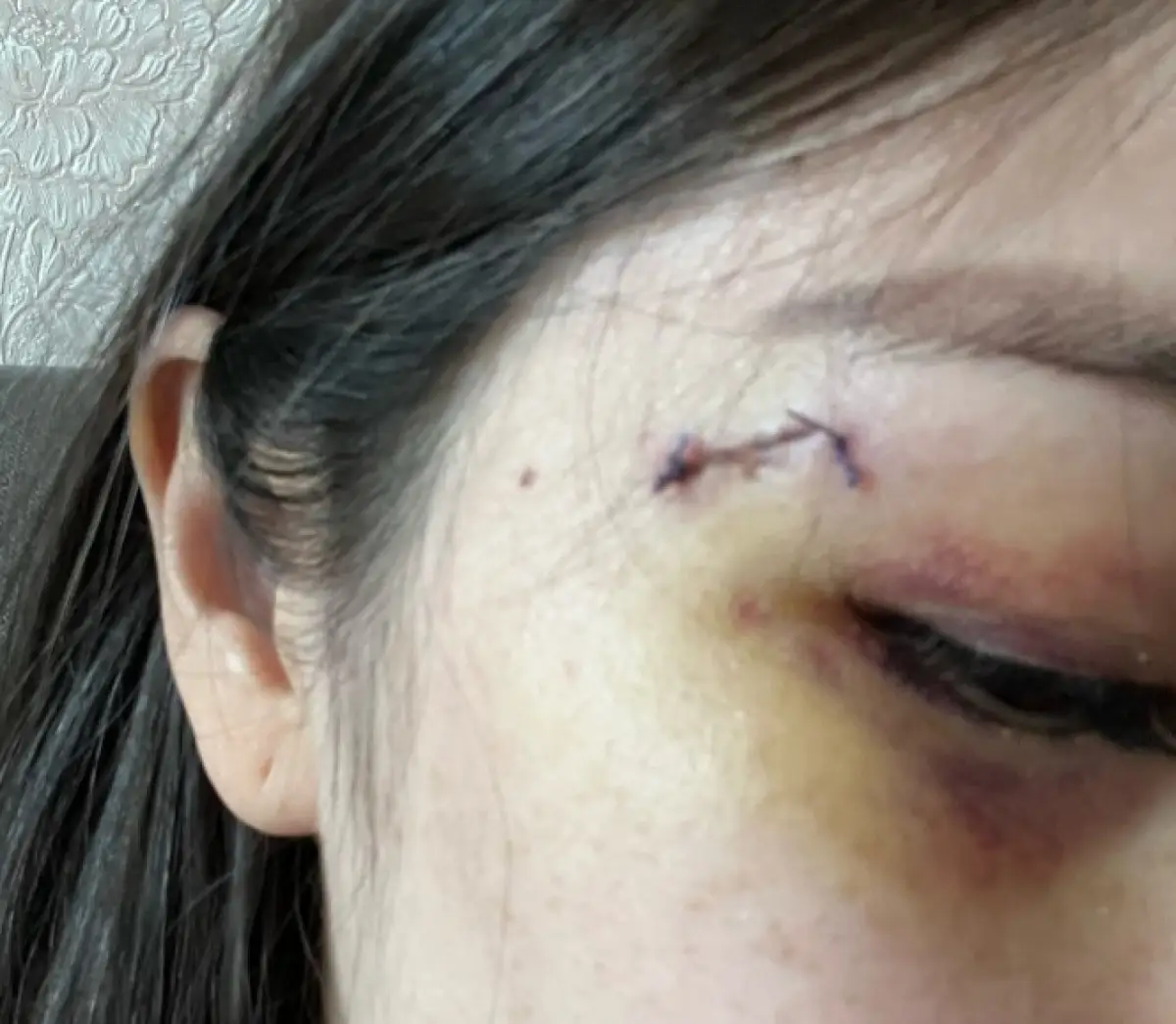 «Менің әкем - офицер»: алматылық әйел гинекологты телефонмен ұрып тастаған